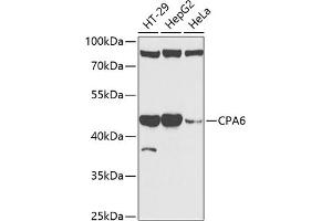 Western blot analysis of extracts of various cell lines, using CP antibody (ABIN6129673, ABIN6138930, ABIN6138932 and ABIN6217722) at 1:1000 dilution. (CPA6 antibody  (AA 130-437))