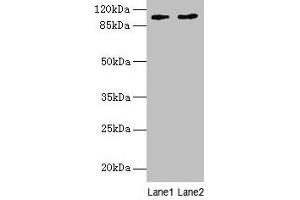 Western blot All lanes: CCDC57 antibody at 1. (CCDC57 antibody  (AA 1-300))