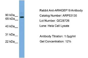 WB Suggested Anti-ARHGEF19  Antibody Titration: 0.