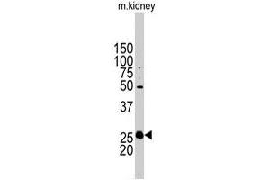 Western blot analysis of STC2 polyclonal antibody  in mouse kidney tissue lysates (35 ug/lane). (Stanniocalcin 2 antibody  (N-Term))