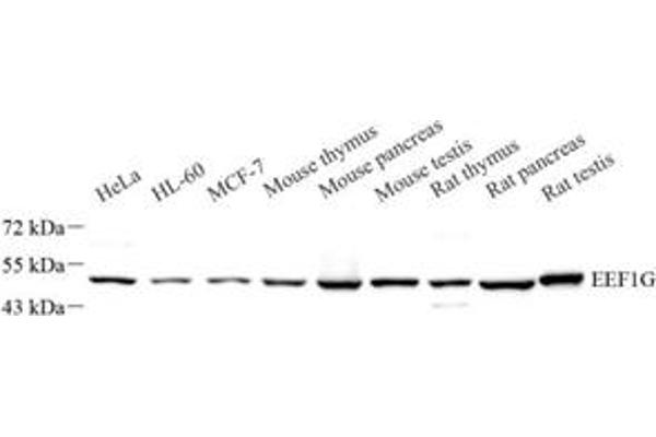 Basonuclin 1 antibody