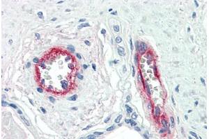 Human Placenta, Vessels (formalin-fixed, paraffin-embedded) stained with F8 antibody ABIN396921 at 10 ug/ml followed by biotinylated anti-mouse IgG secondary antibody ABIN481714, alkaline phosphatase-streptavidin and chromogen. (Factor VIII antibody)
