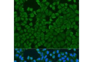 Immunofluorescence analysis of U2OS cells using IL27RA Polyclonal Antibody at dilution of 1:100. (IL27 Receptor alpha antibody)