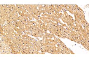 Immunohistochemistry (IHC) image for anti-Chemokine (C-X-C Motif) Receptor 4 (CXCR4) (AA 262-352) antibody (ABIN7432925)