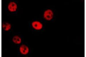 ABIN6279703 staining Hela by IF/ICC. (SFRS14 antibody  (Internal Region))