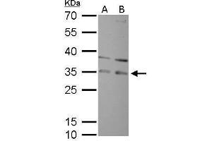 WB Image RPA32 antibody detects RPA2 protein by Western blot analysis. (RPA2 antibody)
