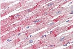 Anti-Nestin antibody IHC staining of human heart. (Nestin antibody)