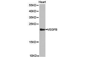 Western Blotting (WB) image for anti-Vascular Endothelial Growth Factor B (VEGFB) antibody (ABIN1875323)