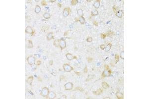Immunohistochemistry of paraffin-embedded rat brain using BRSK1 antibody  at dilution of 1:100 (40x lens). (BRSK1 antibody  (AA 310-510))