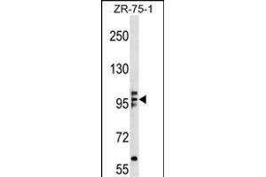 KIF20A Antibody (N-term) (ABIN1539162 and ABIN2848683) western blot analysis in ZR-75-1 cell line lysates (35 μg/lane). (KIF20A antibody  (N-Term))