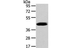 Gel: 8 % SDS-PAGE, Lysate: 40 μg, Lane: Hela cell, Primary antibody: ABIN7128077(VASH2 Antibody) at dilution 1/450 dilution, Secondary antibody: Goat anti rabbit IgG at 1/8000 dilution, Exposure time: 40 seconds (Vasohibin 2 antibody)