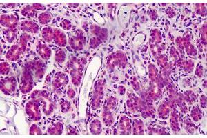Human Breast: Formalin-Fixed, Paraffin-Embedded (FFPE) (FANCC antibody  (C-Term))