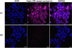 Immunocytochemical staining of HeLa cells using Aladin WD repeat nucleoporin antibody (ABIN7797447), 1:1,000), Top panel: wild-type (WT), Bottom panal: Aladin WD repeat nucleoporin shRNA knockdown (KD). (Adracalin antibody)