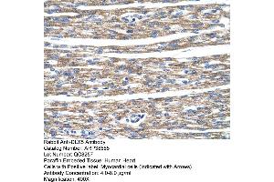 Human Heart (DLX5 antibody  (N-Term))