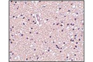 Immunohistochemistry of op18 in human brain tissue with this product at 2. (Stathmin 1 antibody  (N-Term))