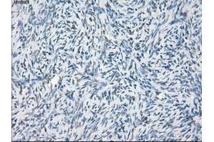 Immunohistochemical staining of paraffin-embedded colon tissue using anti-LTA4H mouse monoclonal antibody. (LTA4H antibody)