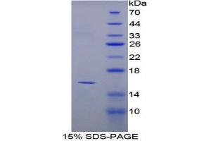 SDS-PAGE analysis of Mouse PPARG Protein. (PPARG Protein)