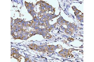 IHC analysis of DHODH using anti-DHODH antibody (ABIN7603139).