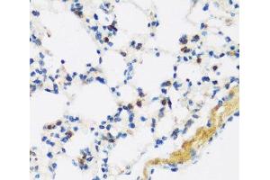 Immunohistochemistry of paraffin-embedded Mouse lung using APOBEC3F Polyclonal Antibody at dilution of 1:100 (40x lens). (APOBEC3F antibody)