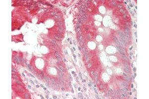 Human Colon: Formalin-Fixed, Paraffin-Embedded (FFPE). (Calpastatin antibody  (FITC))