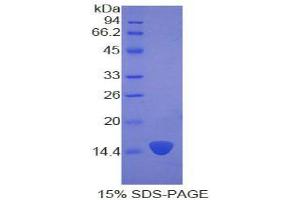 SDS-PAGE analysis of Human Keratin 2 Protein.