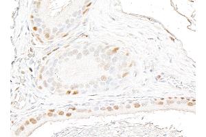 Immunohistochemistry (IHC) image for anti-Androgen Receptor (AR) (AA 1-50) antibody (ABIN7795785) (Recombinant Androgen Receptor antibody  (AA 1-50))