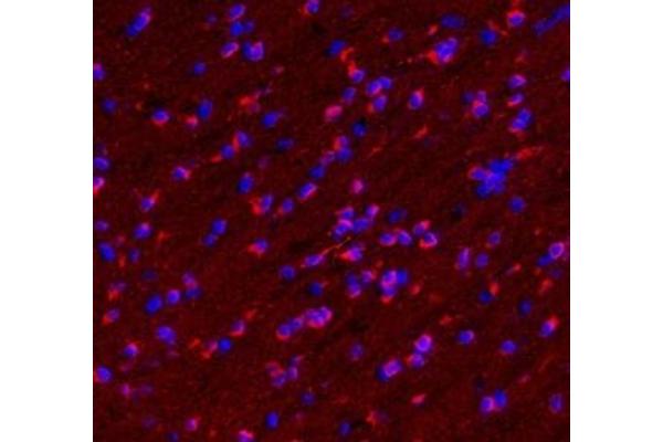 SLC18A2 antibody