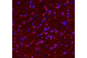 Immunofluorescent analysis of paraformaldehyde-fixed mouse brain using VMAT2 (ABIN7075655) at dilution of 1: 1600 (SLC18A2 antibody)