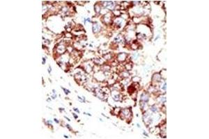 Image no. 2 for anti-Protein Inhibitor of Activated STAT, 1 (PIAS1) (C-Term) antibody (ABIN356763)