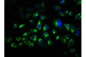 Immunofluorescence staining of Hela cells with ABIN7173546 at 1:66, counter-stained with DAPI. (TRO antibody  (AA 1-164))