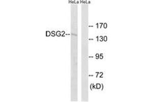 Western blot analysis of extracts from HeLa cells, using DSG2 Antibody.