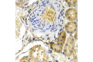 Immunohistochemistry (IHC) image for anti-BCL2-Associated Agonist of Cell Death (BAD) (C-Term) antibody (ABIN3022202) (BAD antibody  (C-Term))