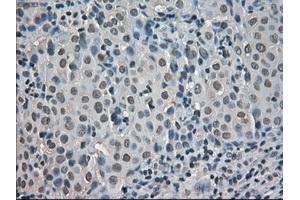 Immunohistochemical staining of paraffin-embedded pancreas tissue using anti-CRYABmouse monoclonal antibody. (CRYAB antibody)
