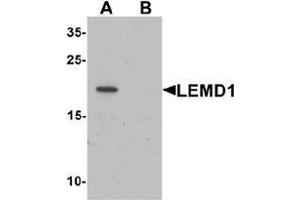 Western blot analysis of LEMD1 in A20 cell lysate with LEMD1 Antibody  at 1 ug/mL in (A) the absence and (B) the presence of blocking peptide. (LEMD1 antibody  (Middle Region))