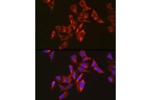 Immunofluorescence analysis of U2OS cells using Sterol carrier protein 2 antibody (ABIN7270597) at dilution of 1:50.