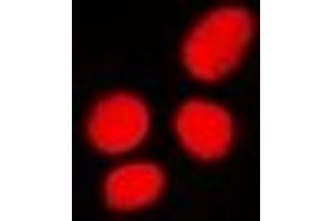 Immunofluorescent analysis of PHC3 staining in U2OS cells. (PHC3 antibody)