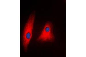 Immunofluorescent analysis of PLC gamma 1 staining in Raw264. (Phospholipase C gamma 1 antibody  (C-Term))