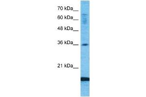 Host:  Rabbit  Target Name:  CCL18  Sample Type:  Fetal Lung lysates  Antibody Dilution:  1. (CCL18 antibody  (Middle Region))