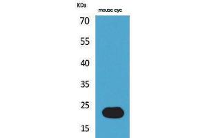 Western Blotting (WB) image for anti-BCL2/adenovirus E1B 19kDa Interacting Protein 3 (BNIP3) (Internal Region) antibody (ABIN3178185) (BNIP3 antibody  (Internal Region))