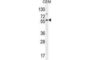 Western blot analysis in CEM cell line lysates (35ug/lane) using NFKBIL1  Antibody . (NFKBIL1 antibody  (Middle Region))