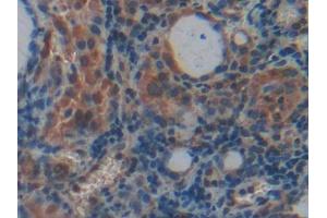Used in DAB staining on fromalin fixed paraffin- embedded rectum tissue (PLXNB1 antibody  (AA 200-727))
