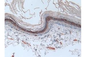 Detection of INV in Rat Skin Tissue using Polyclonal Antibody to Involucrin (INV) (Involucrin antibody  (AA 461-551))