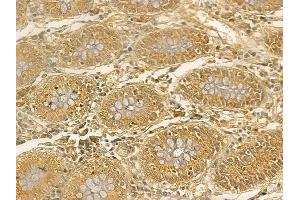 IGF2BP3 Mouse Monoclonal Antibody at 1/100 staining human normal colon tissue by IHC-P.