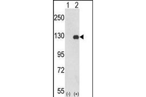 Western blot analysis of PTK2 (arrow) using rabbit polyclonal PTK2 Antibody (C-term) (ABIN652554 and ABIN2842372). (FAK antibody  (C-Term))