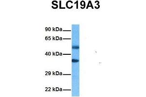 Host:  Rabbit  Target Name:  SLC19A3  Sample Tissue:  Human Ovary Tumor  Antibody Dilution:  1. (SLC19A3 antibody  (Middle Region))