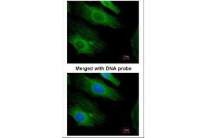 ICC/IF Image Immunofluorescence analysis of paraformaldehyde-fixed HeLa, using H-Ras , antibody at 1:200 dilution. (HRAS antibody  (C-Term))