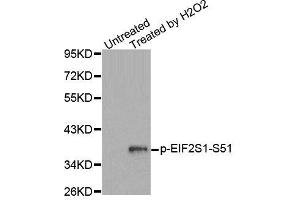 Western blot analysis of extracts from Jurkat cells, using Phospho-EIF2S1-S51 antibody (ABIN2987989). (EIF2S1 antibody  (pSer51))