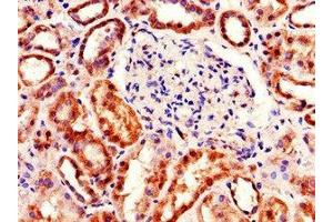 Immunohistochemistry of paraffin-embedded human kidney tissue using ABIN7166667 at dilution of 1:100 (TDRD12 antibody  (AA 991-1164))