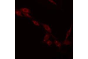 ABIN6275275 staining Hela by IF/ICC. (NDUFV2 antibody  (N-Term))