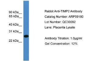 WB Suggested Anti-TIMP2  Antibody Titration: 0. (TIMP2 antibody  (N-Term))